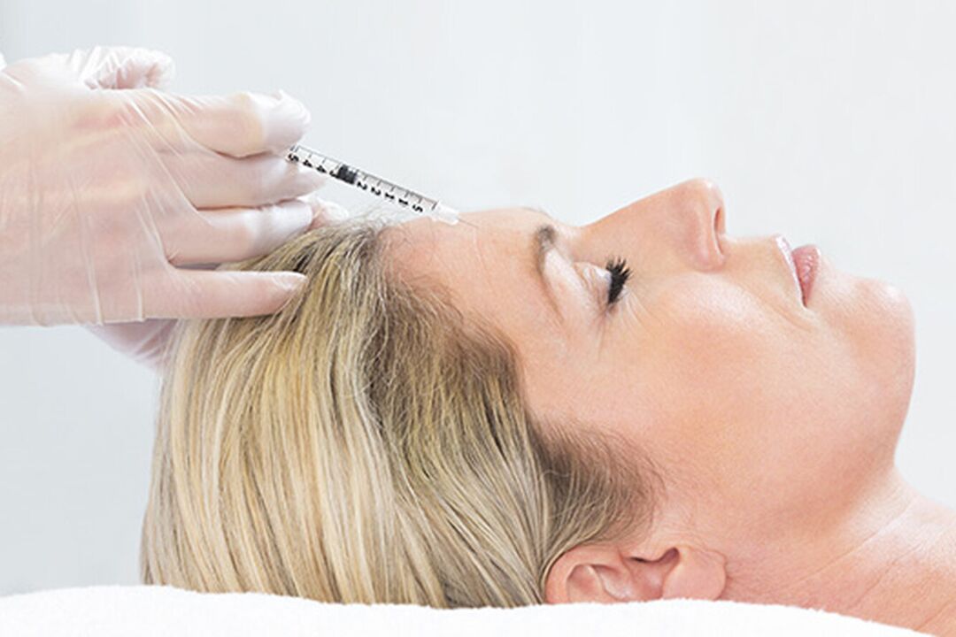 Plasmoliftingul este o metodă de injecție pentru întinerirea pielii feței